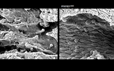 Cover image of Novel therapy starves the engine driving cancer cell growth