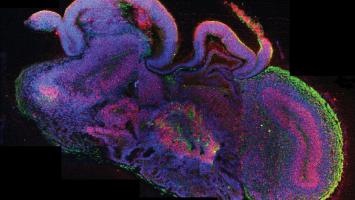 Cover image of Cerebral organoids: an innovative treatment for neurological disorders