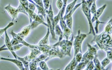 Cover image of Targeting cancer: nanocontainers deliver localised chemotherapy 