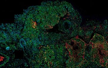 Cover image of Ageing, cancer and the length of your chromosomes