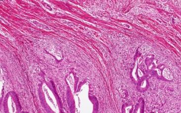 Cover image of Cancer in 3D: in-depth research to uncover its secrets
