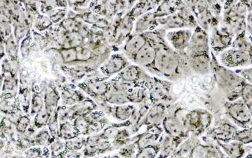 Cover image of An early detection kit for colorectal cancer