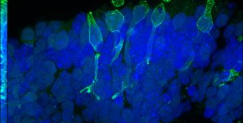 Cover image of Can we grow an artificial retina?