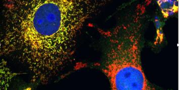 Curbing the cell stress response