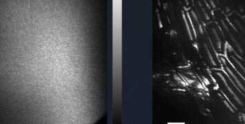 Revolutionizing Optical Imaging