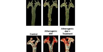 Aortas from mice treated with the bacterial metabolite imidazole propionate (ImP)