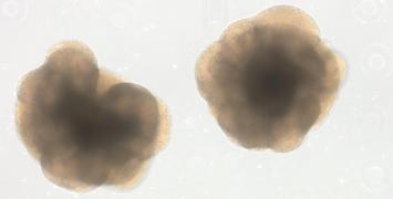 Two brain organoids 