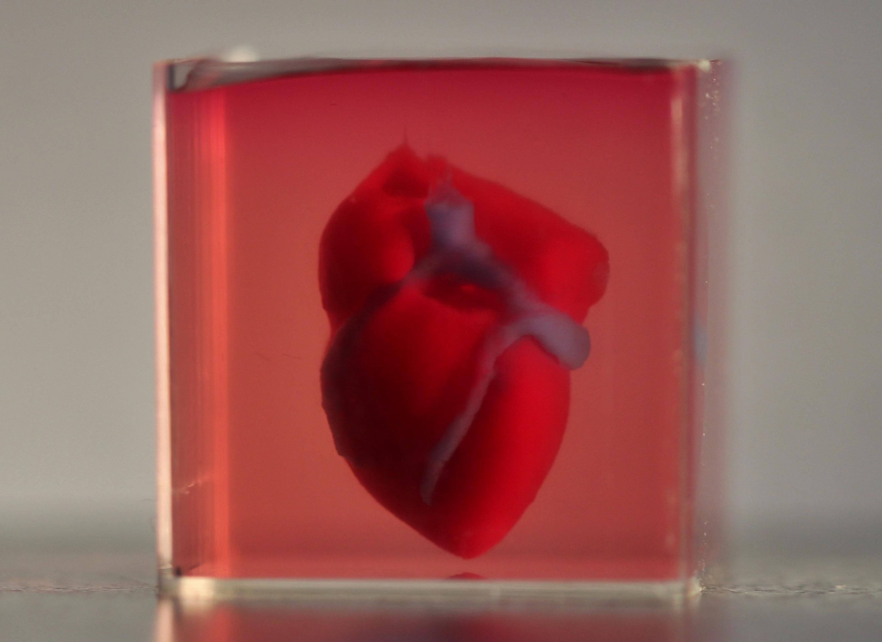 Cover image of Will 3D printed hearts solve organ donors shortage?