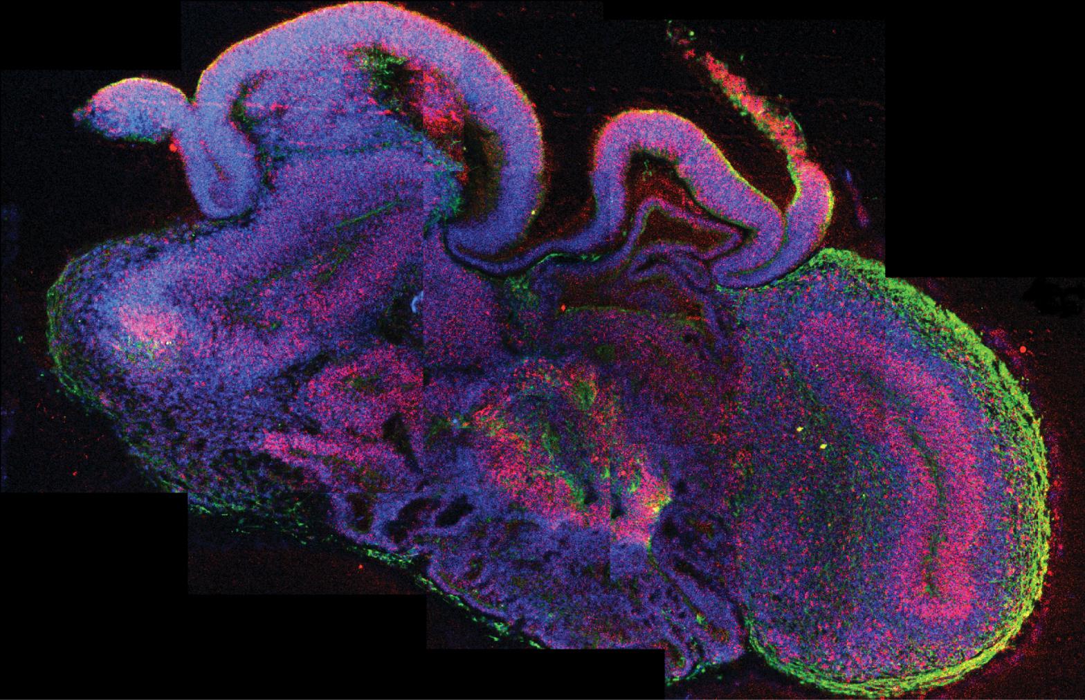 Cover image of Cerebral organoids: an innovative treatment for neurological disorders