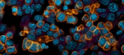 Cover image of Stem cells: from frontier research project to promising spin-off company